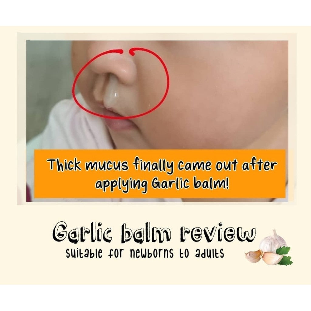 Cough, Flu & Phlegm Survival Kit (Garlic balm, Turmeric, Sniffles, Lemon Soap)